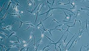 Human Primary Cardiac Fibroblasts